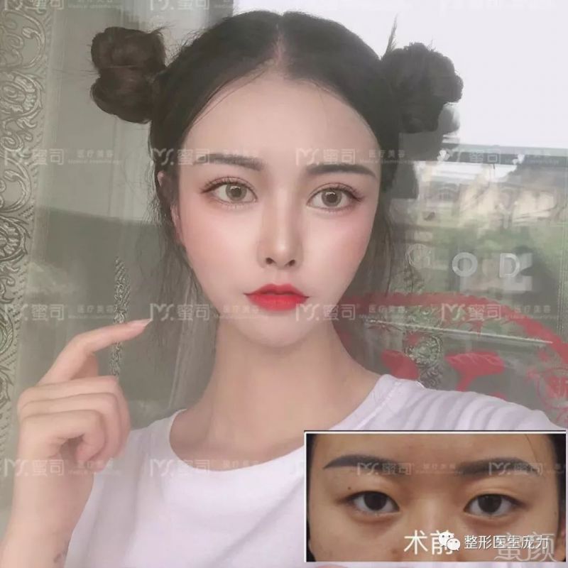 https://img.miyanlife.com/mnt/timg/190831/124934E44-3.jpg