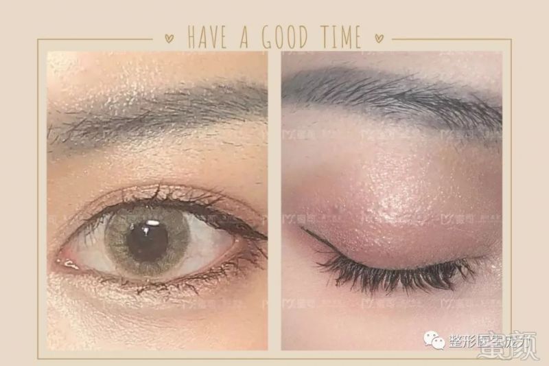 https://img.miyanlife.com/mnt/timg/190831/12493G564-8.jpg