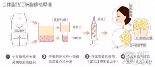 https://img.miyanlife.com/mnt/timg/190831/124H12N7-3.jpg