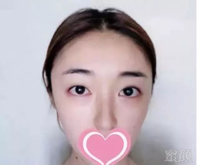https://img.miyanlife.com/mnt/timg/190831/124K463M-0.jpg