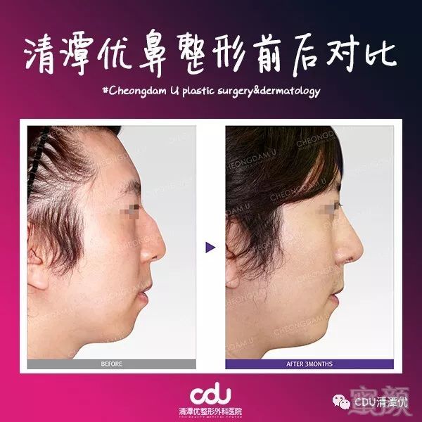 https://img.miyanlife.com/mnt/timg/190831/130U233H-3.jpg