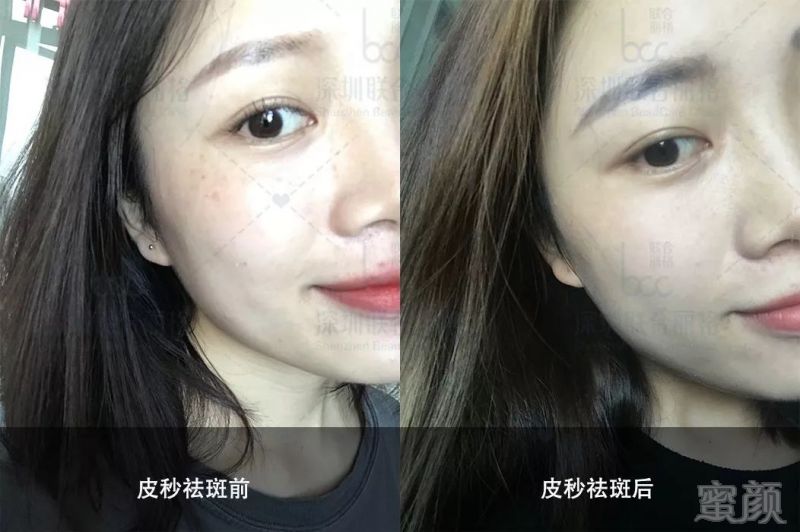 https://img.miyanlife.com/mnt/timg/190831/131013N37-0.jpg