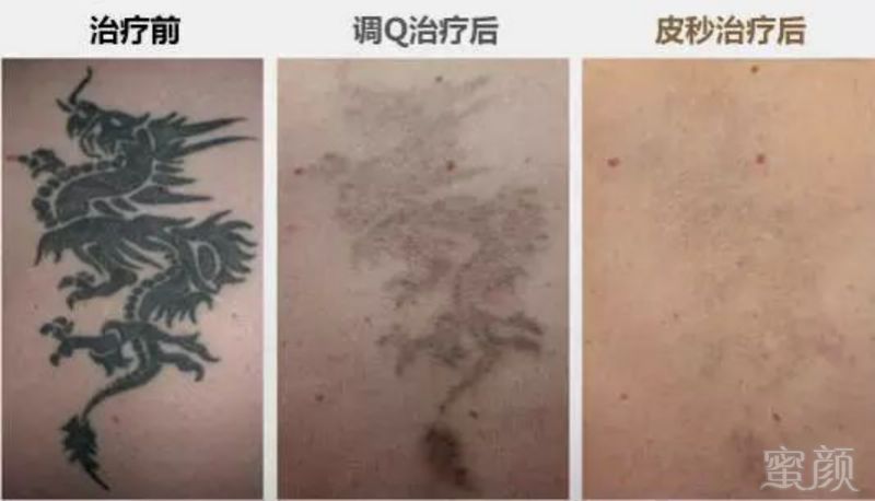 https://img.miyanlife.com/mnt/timg/190831/1316223C4-10.jpg