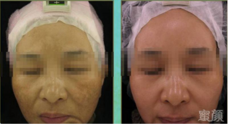 https://img.miyanlife.com/mnt/timg/190831/1316224Z6-9.jpg