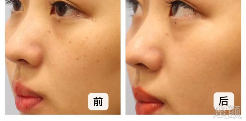 https://img.miyanlife.com/mnt/timg/190831/131K031V-11.jpg