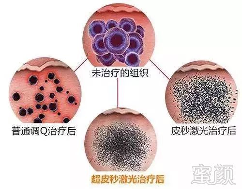 https://img.miyanlife.com/mnt/timg/190831/131S23I5-2.jpg
