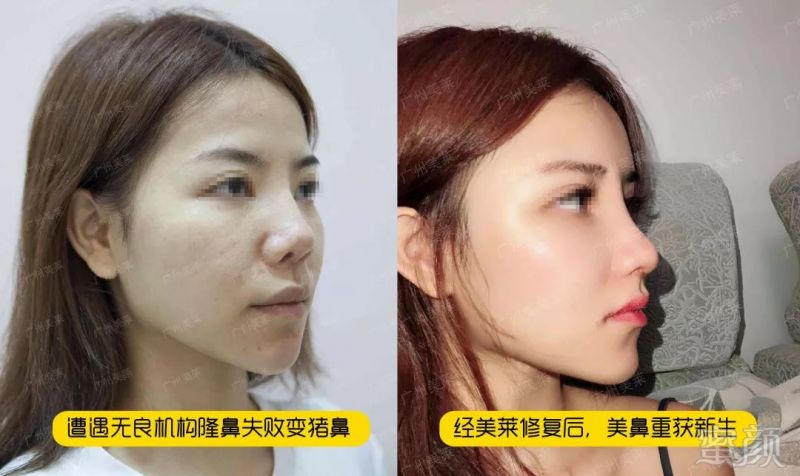 https://img.miyanlife.com/mnt/timg/190831/1320524910-4.jpg