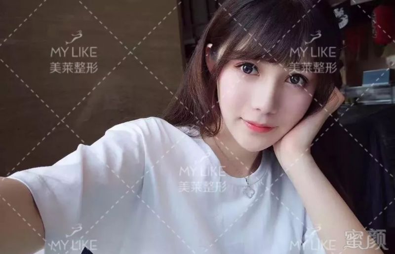 https://img.miyanlife.com/mnt/timg/190901/102200FM-0.jpg