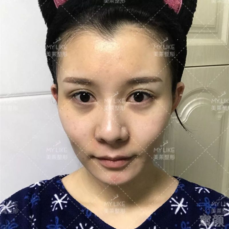 https://img.miyanlife.com/mnt/timg/190901/10220140T-1.jpg