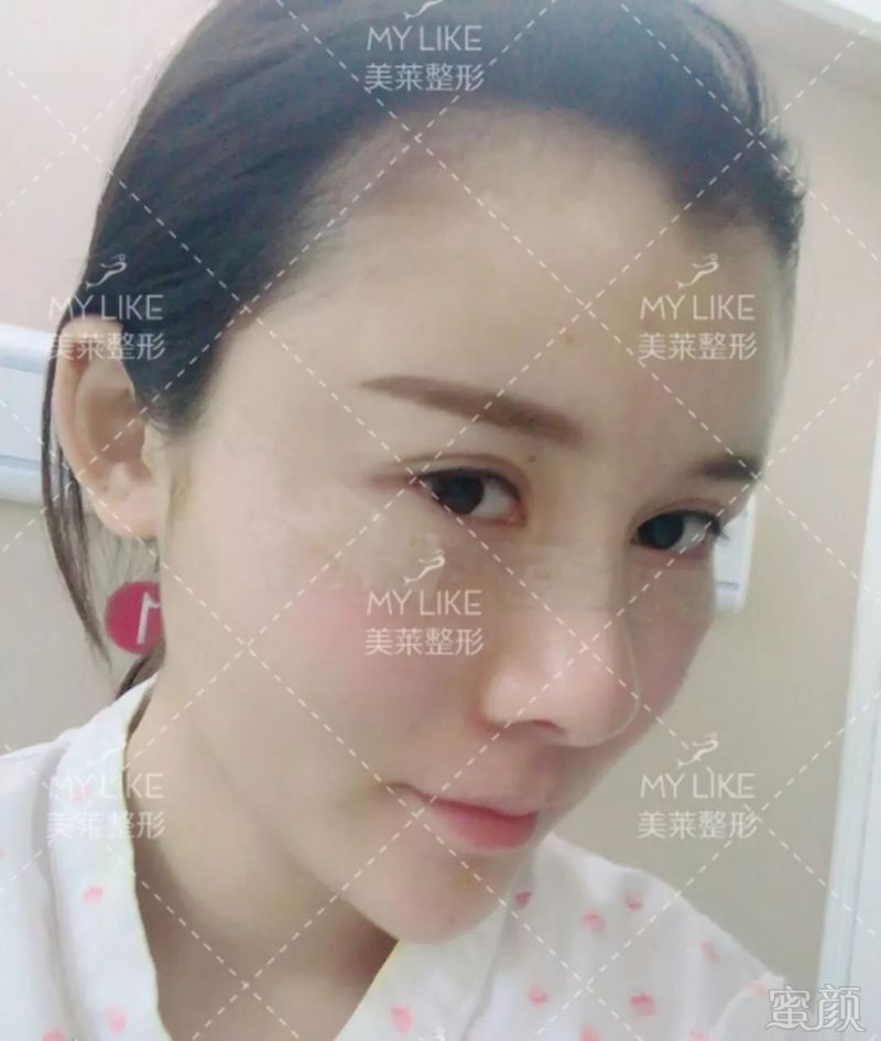 https://img.miyanlife.com/mnt/timg/190901/1022096219-5.jpg