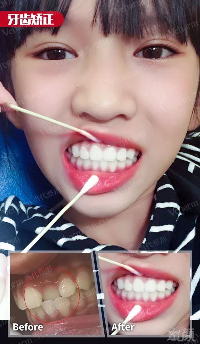 https://img.miyanlife.com/mnt/timg/190901/104U920F-6.jpg