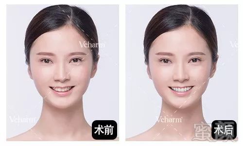 https://img.miyanlife.com/mnt/timg/190901/104Z12a1-8.jpg