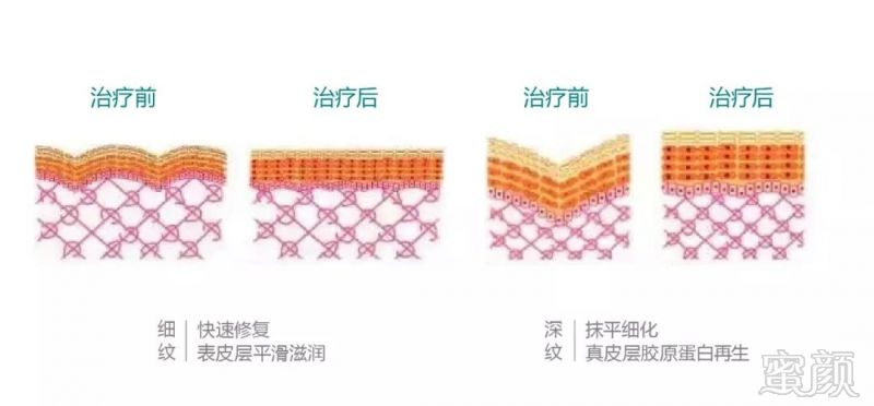 https://img.miyanlife.com/mnt/timg/190901/1059533916-11.jpg
