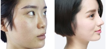 https://img.miyanlife.com/mnt/timg/190901/1242164120-5.jpg
