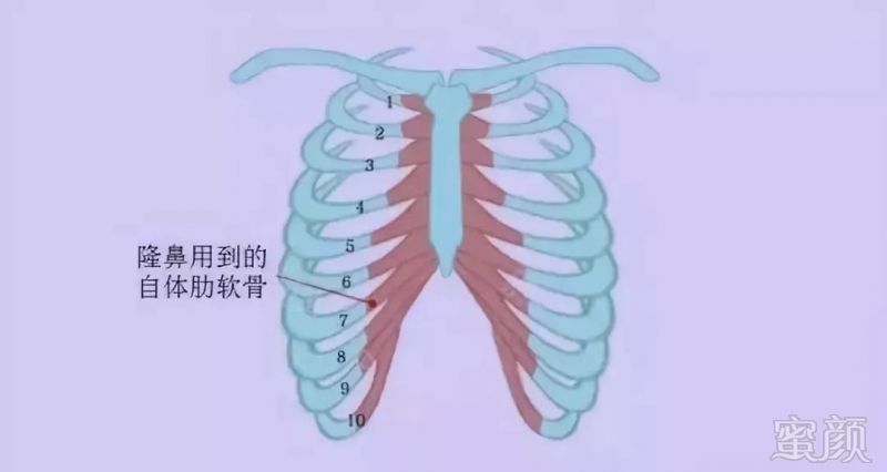 https://img.miyanlife.com/mnt/timg/190901/130P92032-3.jpg