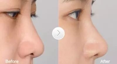 https://img.miyanlife.com/mnt/timg/190901/130PW091-2.jpg