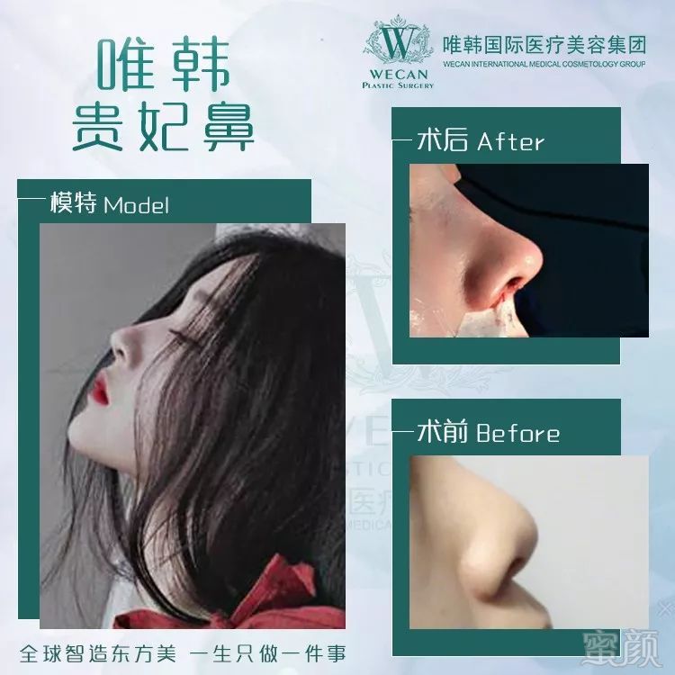 https://img.miyanlife.com/mnt/timg/190901/130Q154Y-6.jpg