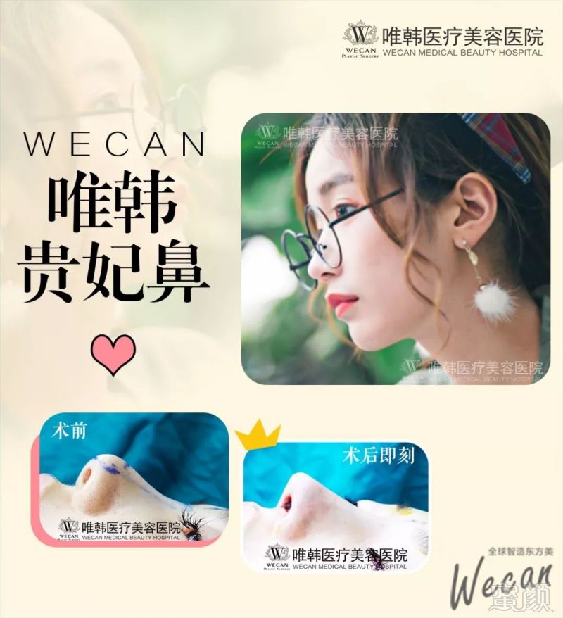https://img.miyanlife.com/mnt/timg/190901/130Q234V-7.jpg
