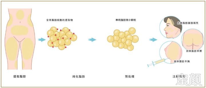 案例图片