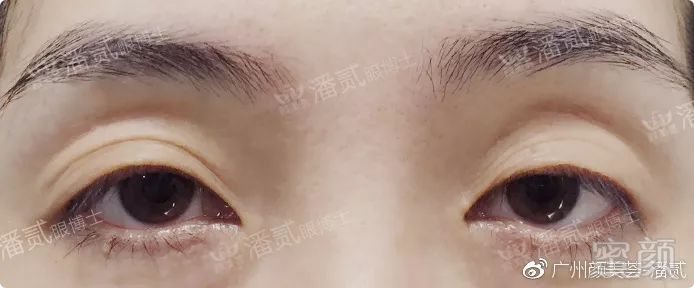 https://img.miyanlife.com/mnt/timg/190902/14400TM3-0.jpg