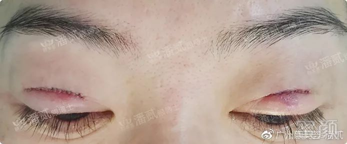 https://img.miyanlife.com/mnt/timg/190902/1440104Q3-2.jpg