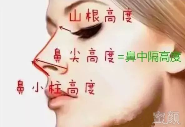 https://img.miyanlife.com/mnt/timg/190902/144H24443-4.jpg