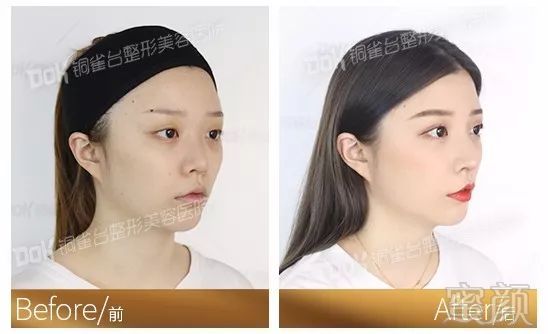 https://img.miyanlife.com/mnt/timg/190902/1456293508-12.jpg