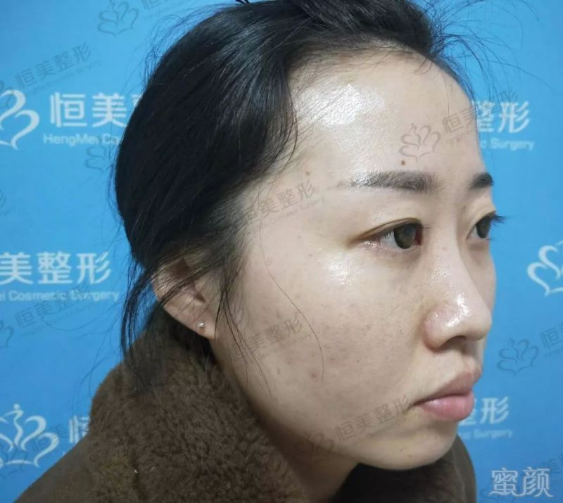 https://img.miyanlife.com/mnt/timg/190902/15045MV8-1.jpg