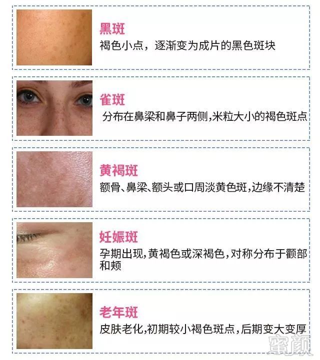 https://img.miyanlife.com/mnt/timg/190902/15113234Z-2.jpg