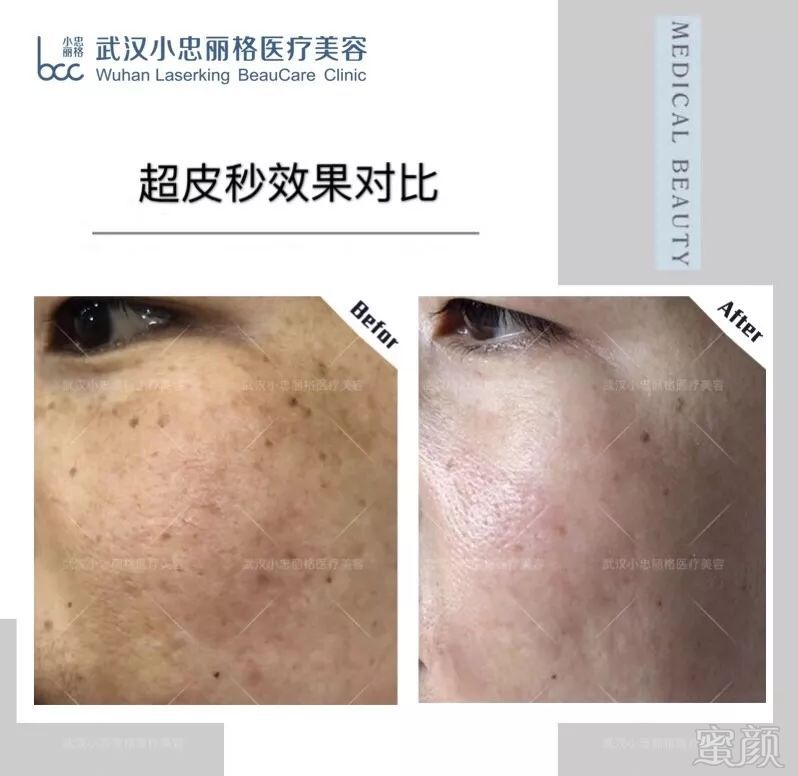 https://img.miyanlife.com/mnt/timg/190902/151133H24-5.jpg