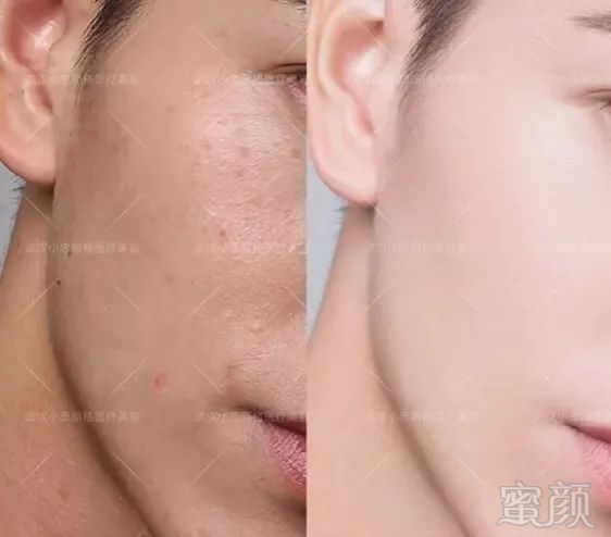 https://img.miyanlife.com/mnt/timg/190902/151134F57-6.jpg