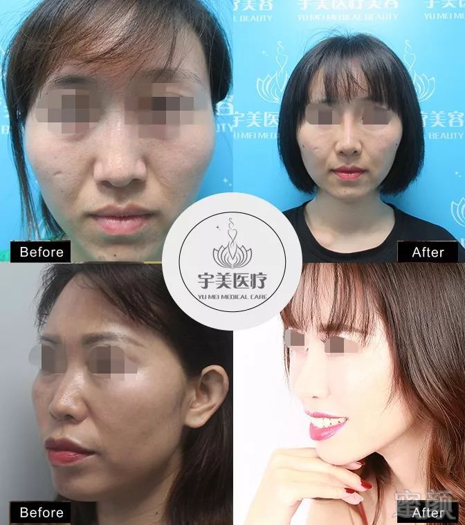 https://img.miyanlife.com/mnt/timg/190903/123942M15-3.jpg