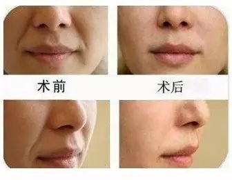 https://img.miyanlife.com/mnt/timg/190903/123T93402-12.jpg