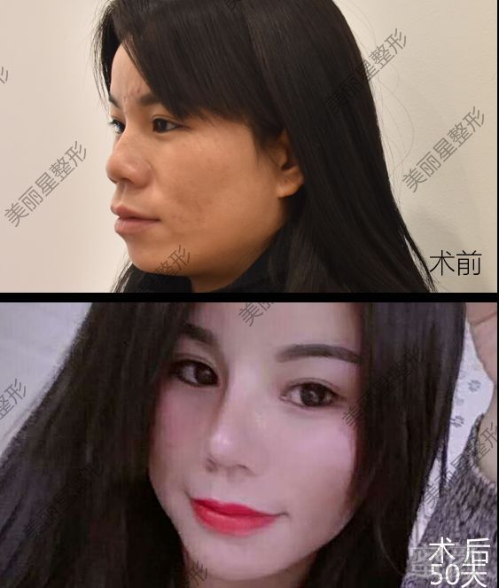 https://img.miyanlife.com/mnt/timg/190903/123Z610T-1.jpg