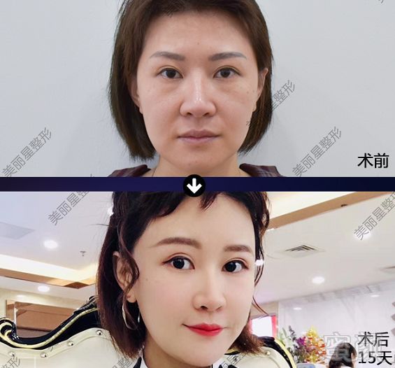 https://img.miyanlife.com/mnt/timg/190903/123ZBO0-0.jpg