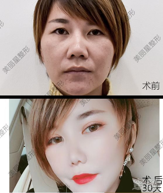 https://img.miyanlife.com/mnt/timg/190903/123ZHG2-2.jpg
