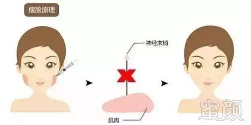 https://img.miyanlife.com/mnt/timg/190903/12443V119-7.jpg