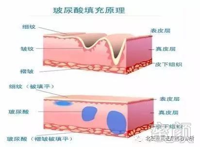 https://img.miyanlife.com/mnt/timg/190903/1252355014-3.jpg