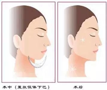 https://img.miyanlife.com/mnt/timg/190903/1254443T2-3.jpg