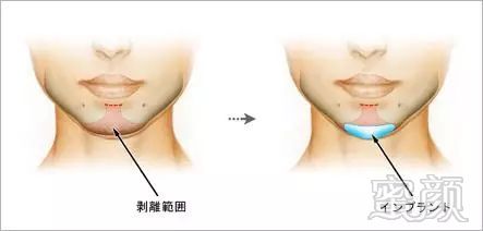 https://img.miyanlife.com/mnt/timg/190903/1254453415-4.jpg