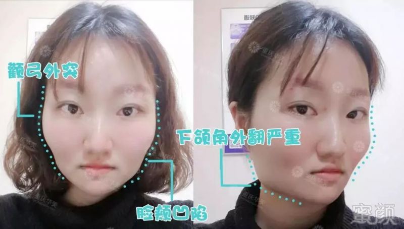 https://img.miyanlife.com/mnt/timg/190903/140Fa4H-6.jpg