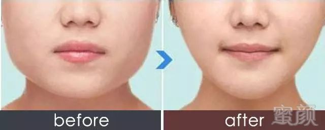 https://img.miyanlife.com/mnt/timg/190903/14144311X-6.jpg