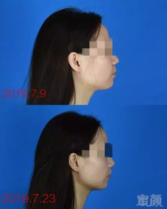 https://img.miyanlife.com/mnt/timg/190903/1414442124-9.jpg
