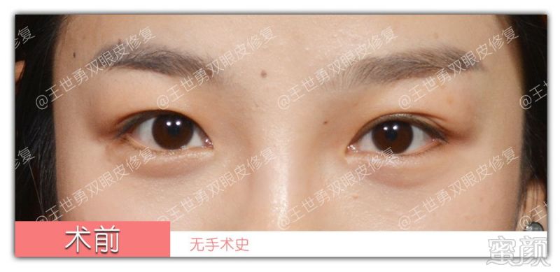 https://img.miyanlife.com/mnt/timg/190903/144J03932-0.jpg