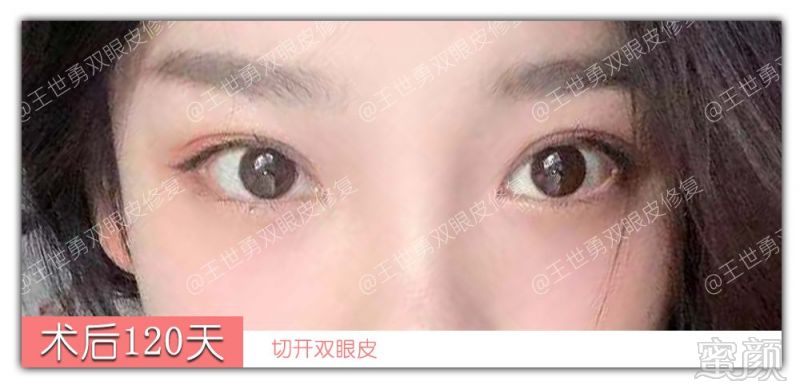 https://img.miyanlife.com/mnt/timg/190903/144J131O-1.jpg