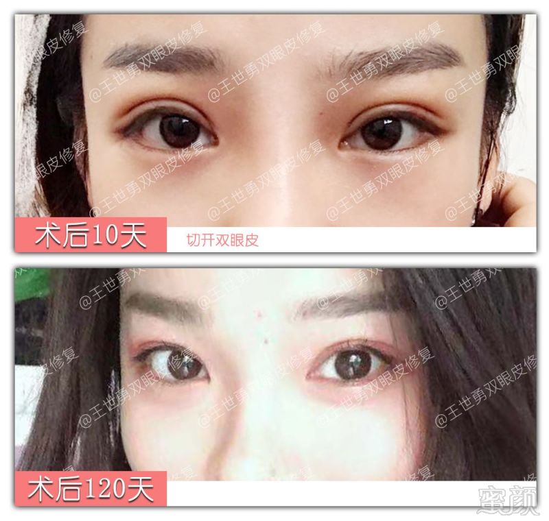 https://img.miyanlife.com/mnt/timg/190903/144J2C42-3.jpg