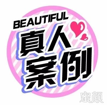https://img.miyanlife.com/mnt/timg/190904/13213A140-0.jpg