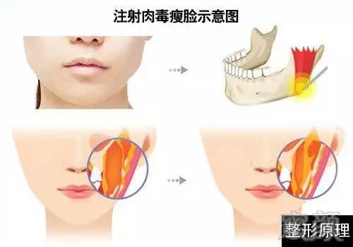 https://img.miyanlife.com/mnt/timg/190904/13233V358-3.jpg
