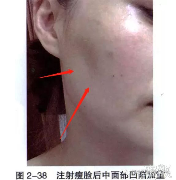 https://img.miyanlife.com/mnt/timg/190904/132Z5EE-7.jpg