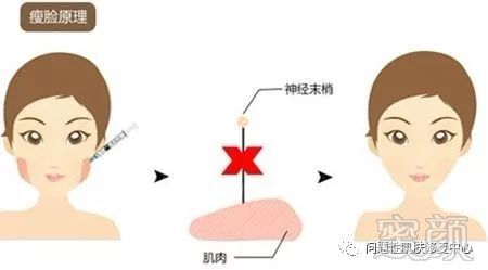 https://img.miyanlife.com/mnt/timg/190904/132Z62H6-9.jpg